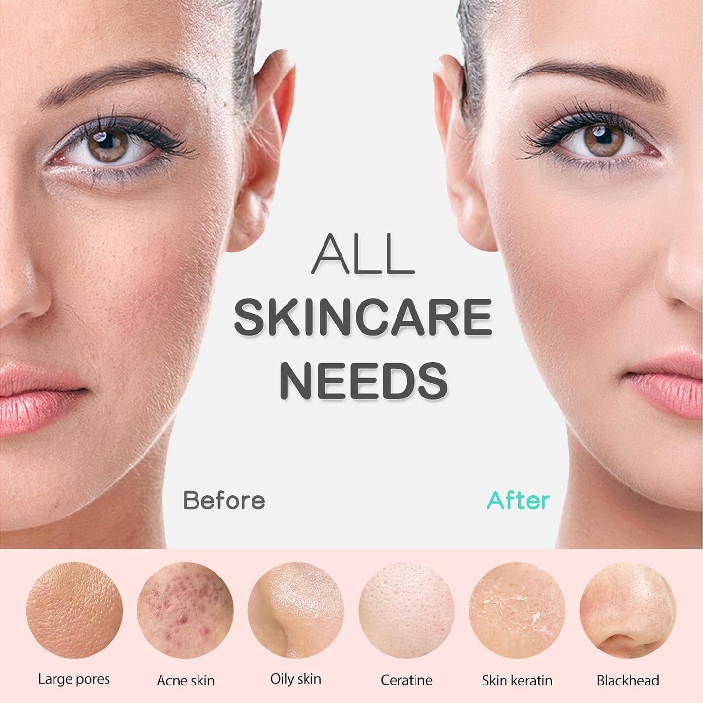 Masajeador Facial Ultrasónico